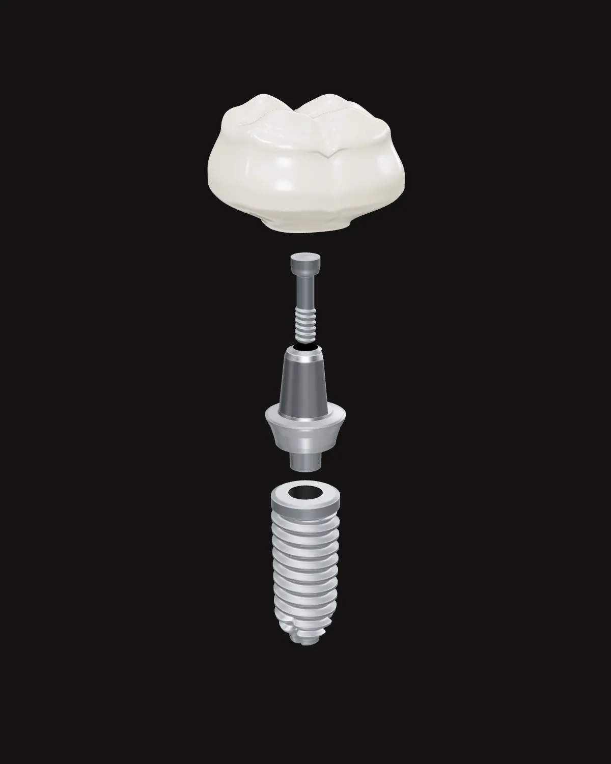Patlatılmış çizim: zirkonyum kron, abutment vidası, abutment ve implant gövdesi